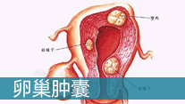 卵巢囊肿的原因_马鞍山妇科医院