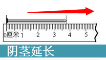 阴茎短小治疗_马鞍山男科医院